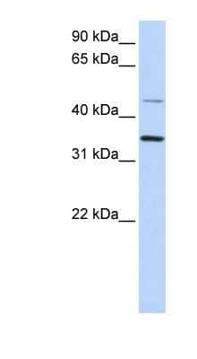 Western Blot: CLN6 Antibody [NBP1-59415]