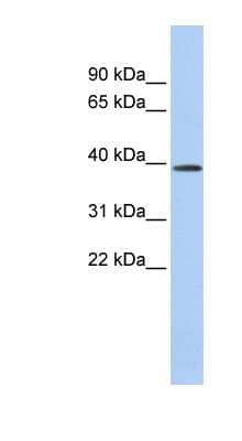 Western Blot: CLN6 Antibody [NBP1-59646]