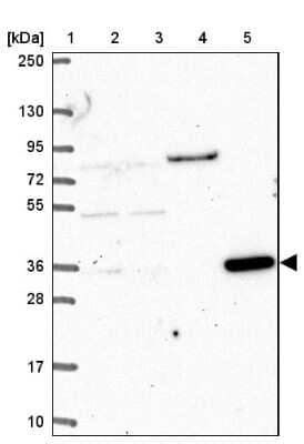 Western Blot: CLN6 Antibody [NBP2-39066]