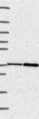 Western Blot: CLN6 Antibody [NBP3-17819]