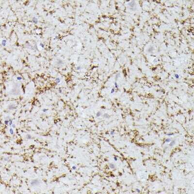 Immunohistochemistry-Paraffin: CLN8 Antibody - Azide and BSA Free [NBP2-92342]