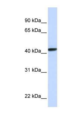 Western Blot: CLN8 Antibody [NBP1-91333]