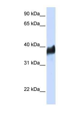 Western Blot: CLN8 Antibody [NBP1-91334]