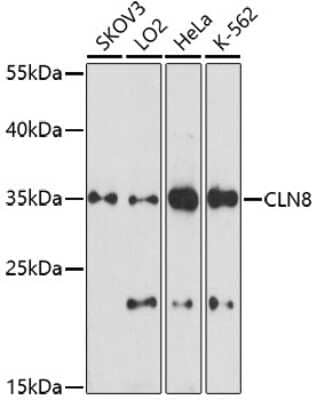 Western Blot: CLN8 AntibodyAzide and BSA Free [NBP2-92342]