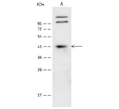 Western Blot: CLN8 Antibody [NBP2-99467]