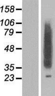 Western Blot: CLN8 Overexpression Lysate [NBP2-06756]