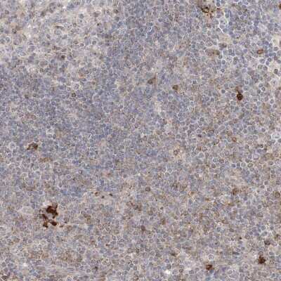 Immunohistochemistry-Paraffin: CLNK Antibody [NBP1-93457]