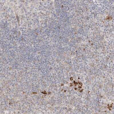 Immunohistochemistry-Paraffin: CLNK Antibody [NBP1-93458]