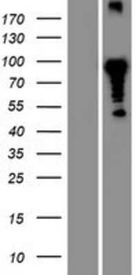 Western Blot: CLNK Overexpression Lysate [NBP2-05833]