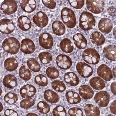 Immunohistochemistry-Paraffin: CLNS1A Antibody [NBP2-33958]