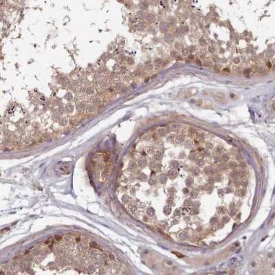 Immunohistochemistry-Paraffin: CLNS1A Antibody [NBP2-33959]