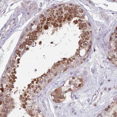 Immunohistochemistry-Paraffin: CLNS1A Antibody [NBP2-33964]