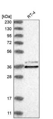 Western Blot: CLNS1A Antibody [NBP2-33959]