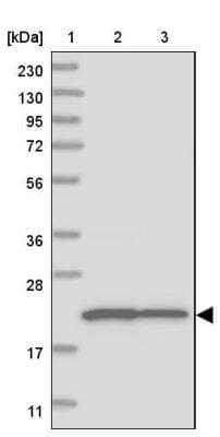 Western Blot: CLNS1A Antibody [NBP2-33964]