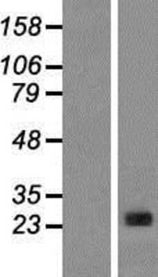 Western Blot: CLNS1A Overexpression Lysate [NBP2-08217]