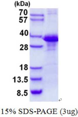 SDS-PAGE: Recombinant Human CLNS1A His Protein [NBP2-22777]