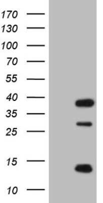 Western Blot: CLOCK Antibody (OTI2H7) [NBP2-46311]