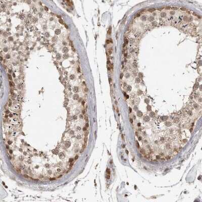 Immunohistochemistry-Paraffin: CLOCK Antibody [NBP1-88614]