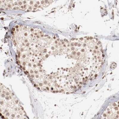 Immunohistochemistry-Paraffin: CLOCK Antibody [NBP1-88615]