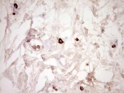Immunohistochemistry: CLOCK Antibody (OTI2H7) - Azide and BSA Free [NBP2-71479]