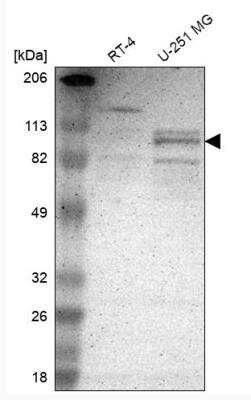 Western Blot: CLOCK Antibody [NBP1-88615]