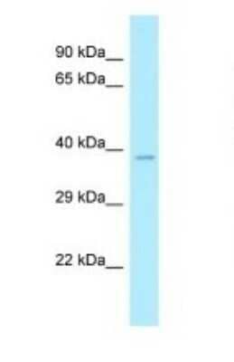 Western Blot: CLP1/HEAB Antibody [NBP1-98452]