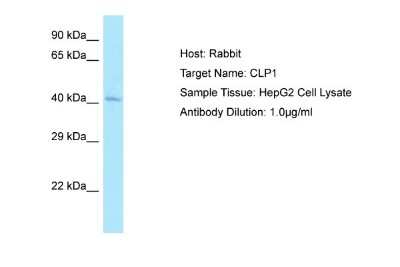 Western Blot: CLP1/HEAB Antibody [NBP1-98453]