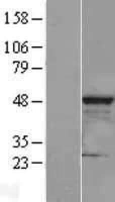 Western Blot: CLP1/HEAB Overexpression Lysate [NBL1-09277]