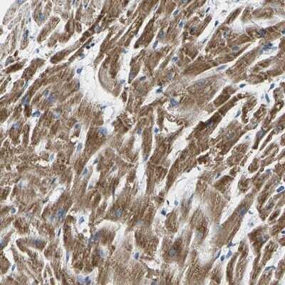 Immunohistochemistry-Paraffin: CLP24/TMEM204 Antibody [NBP1-88444]