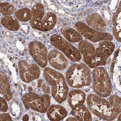 Immunohistochemistry: CLPB Antibody [NBP2-32629]