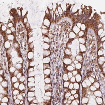 Immunohistochemistry: CLPB Antibody [NBP2-49420]