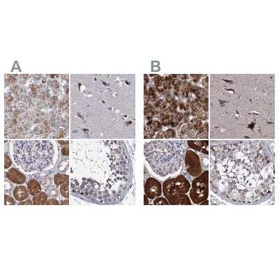 Immunohistochemistry-Paraffin: CLPB Antibody [NBP2-32629]