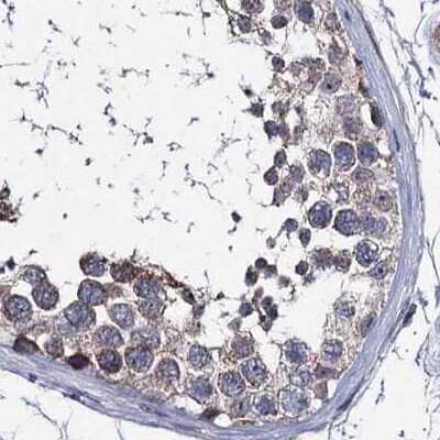Immunohistochemistry-Paraffin: CLPB Antibody [NBP2-32629]