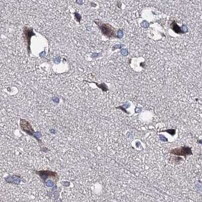 Immunohistochemistry-Paraffin: CLPB Antibody [NBP2-32629]