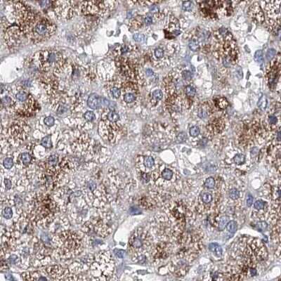 Immunohistochemistry-Paraffin: CLPB Antibody [NBP2-32629]