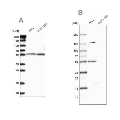 Western Blot: CLPB Antibody [NBP1-83703]