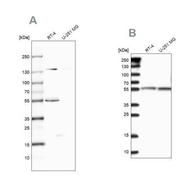 Western Blot: CLPB Antibody [NBP2-32629]