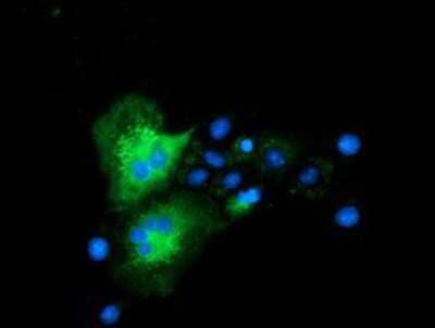Immunocytochemistry/ Immunofluorescence: CLPP Antibody (OTI1F6) [NBP2-03323]