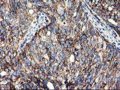 Immunohistochemistry-Paraffin: CLPP Antibody (OTI1F6) [NBP2-03323]