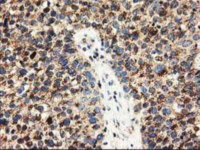 Immunohistochemistry-Paraffin: CLPP Antibody (OTI1F6) [NBP2-03323]