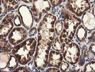 Immunohistochemistry-Paraffin: CLPP Antibody (OTI1F6) [NBP2-03323]