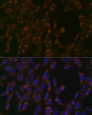 Immunocytochemistry/ Immunofluorescence: CLPP Antibody (1W6O4) [NBP3-16156]