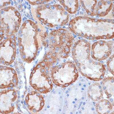 Immunohistochemistry-Paraffin: CLPP Antibody (1W6O4) [NBP3-16156]