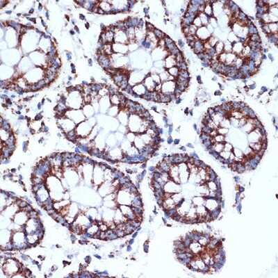 Immunohistochemistry-Paraffin: CLPP Antibody (1W6O4) [NBP3-16156]