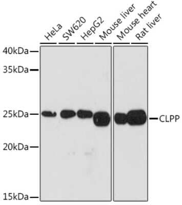 Western Blot: CLPP Antibody (1W6O4) [NBP3-16156]