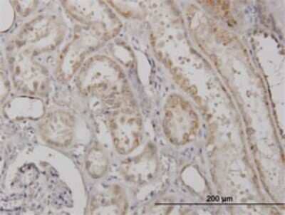 Immunohistochemistry-Paraffin: CLPP Antibody (3E2) [H00008192-M01]
