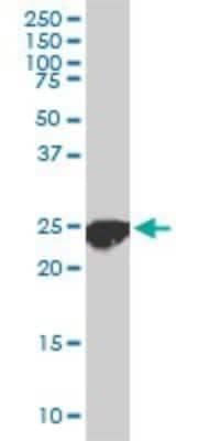 Western Blot: CLPP Antibody (3E2) [H00008192-M01]