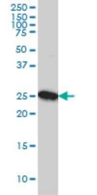 Western Blot: CLPP Antibody (3E2) [H00008192-M01]