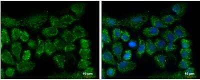 Immunocytochemistry/ Immunofluorescence: CLPP Antibody [NBP1-31011]