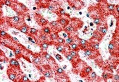 Immunohistochemistry-Paraffin: CLPP Antibody [NB100-1189]